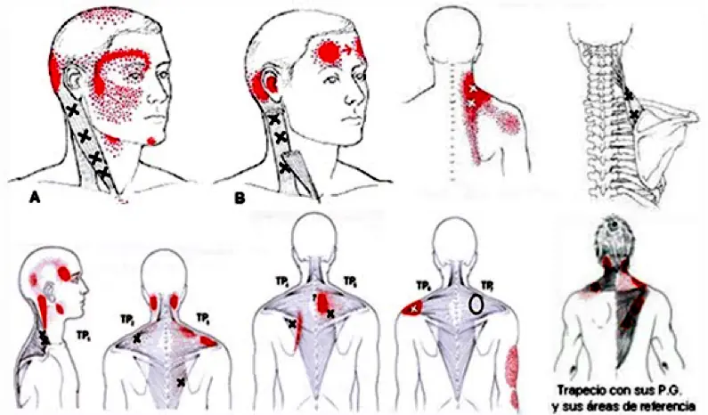 gatillo12